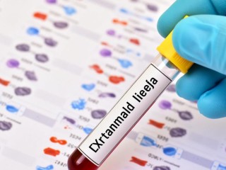 血清学试验究竟检测什么？其原理和应用是什么？